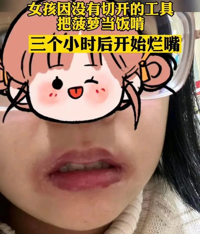 女孩菠萝当午饭 吃完后嘴巴烂掉(菠萝烂嘴)