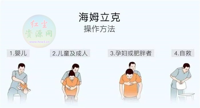 海姆立克急救法的作用是什么(气道异物梗阻急救)